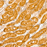 IRF3 Antibody in Immunohistochemistry (Paraffin) (IHC (P))