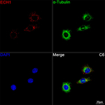 ECH1 Antibody in Immunocytochemistry (ICC/IF)