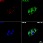 ECH1 Antibody in Immunocytochemistry (ICC/IF)