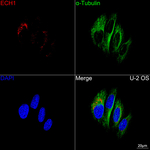 ECH1 Antibody in Immunocytochemistry (ICC/IF)