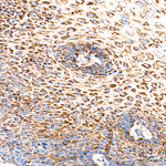 ECH1 Antibody in Immunohistochemistry (Paraffin) (IHC (P))