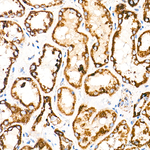 ECH1 Antibody in Immunohistochemistry (Paraffin) (IHC (P))