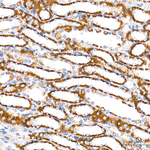 ECH1 Antibody in Immunohistochemistry (Paraffin) (IHC (P))