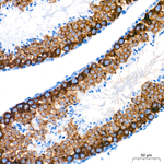 DDX4 Antibody in Immunohistochemistry (Paraffin) (IHC (P))