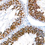 DDX4 Antibody in Immunohistochemistry (Paraffin) (IHC (P))