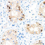 DDX4 Antibody in Immunohistochemistry (Paraffin) (IHC (P))