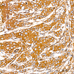 DYNC1H1 Antibody in Immunohistochemistry (Paraffin) (IHC (P))