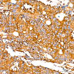 DYNC1H1 Antibody in Immunohistochemistry (Paraffin) (IHC (P))