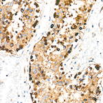 DYNC1H1 Antibody in Immunohistochemistry (Paraffin) (IHC (P))