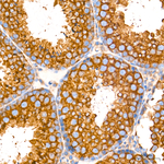 DYNC1H1 Antibody in Immunohistochemistry (Paraffin) (IHC (P))