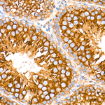 DYNC1H1 Antibody in Immunohistochemistry (Paraffin) (IHC (P))