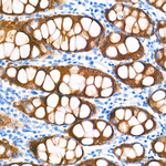 HSD17B2 Antibody in Immunohistochemistry (Paraffin) (IHC (P))