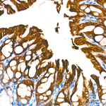 HSD17B2 Antibody in Immunohistochemistry (Paraffin) (IHC (P))