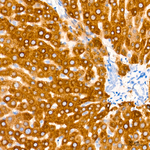 HSD17B2 Antibody in Immunohistochemistry (Paraffin) (IHC (P))