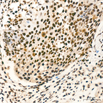 ADAR1 Antibody in Immunohistochemistry (Paraffin) (IHC (P))