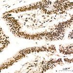ADAR1 Antibody in Immunohistochemistry (Paraffin) (IHC (P))