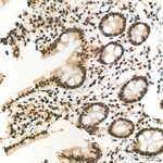 ADAR1 Antibody in Immunohistochemistry (Paraffin) (IHC (P))
