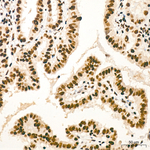 ADAR1 Antibody in Immunohistochemistry (Paraffin) (IHC (P))