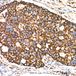 ECHS1 Antibody in Immunohistochemistry (Paraffin) (IHC (P))