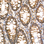 ECHS1 Antibody in Immunohistochemistry (Paraffin) (IHC (P))