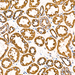 ECHS1 Antibody in Immunohistochemistry (Paraffin) (IHC (P))