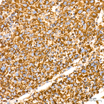 ECHS1 Antibody in Immunohistochemistry (Paraffin) (IHC (P))