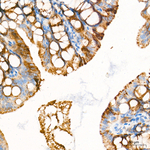ECHS1 Antibody in Immunohistochemistry (Paraffin) (IHC (P))