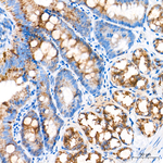 ECHS1 Antibody in Immunohistochemistry (Paraffin) (IHC (P))