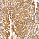 ECHS1 Antibody in Immunohistochemistry (Paraffin) (IHC (P))