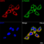 G6PD Antibody in Immunocytochemistry (ICC/IF)