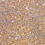 G6PD Antibody in Immunohistochemistry (Paraffin) (IHC (P))