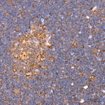 G6PD Antibody in Immunohistochemistry (Paraffin) (IHC (P))