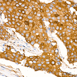 G6PD Antibody in Immunohistochemistry (Paraffin) (IHC (P))