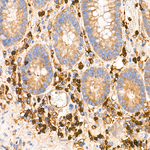 G6PD Antibody in Immunohistochemistry (Paraffin) (IHC (P))