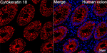 Cytokeratin 18 Antibody in Immunohistochemistry (Paraffin) (IHC (P))