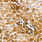 Cytokeratin 18 Antibody in Immunohistochemistry (Paraffin) (IHC (P))