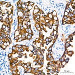 Cytokeratin 18 Antibody in Immunohistochemistry (Paraffin) (IHC (P))