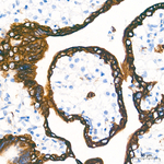 Cytokeratin 18 Antibody in Immunohistochemistry (Paraffin) (IHC (P))