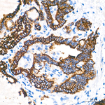 Cytokeratin 18 Antibody in Immunohistochemistry (Paraffin) (IHC (P))
