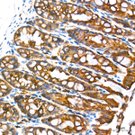 Cytokeratin 18 Antibody in Immunohistochemistry (Paraffin) (IHC (P))