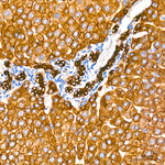 Cytokeratin 18 Antibody in Immunohistochemistry (Paraffin) (IHC (P))