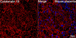 Cytokeratin 18 Antibody in Immunohistochemistry (Paraffin) (IHC (P))