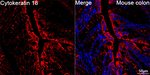 Cytokeratin 18 Antibody in Immunohistochemistry (Paraffin) (IHC (P))