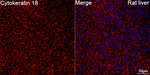 Cytokeratin 18 Antibody in Immunohistochemistry (Paraffin) (IHC (P))