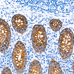 Cytokeratin 18 Antibody in Immunohistochemistry (Paraffin) (IHC (P))