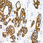 Cytokeratin 18 Antibody in Immunohistochemistry (Paraffin) (IHC (P))