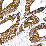 Cytokeratin 18 Antibody in Immunohistochemistry (Paraffin) (IHC (P))