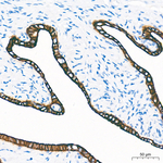 Cytokeratin 18 Antibody in Immunohistochemistry (Paraffin) (IHC (P))