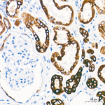 Cytokeratin 18 Antibody in Immunohistochemistry (Paraffin) (IHC (P))