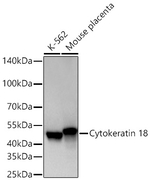 Cytokeratin 18 Antibody in Western Blot (WB)